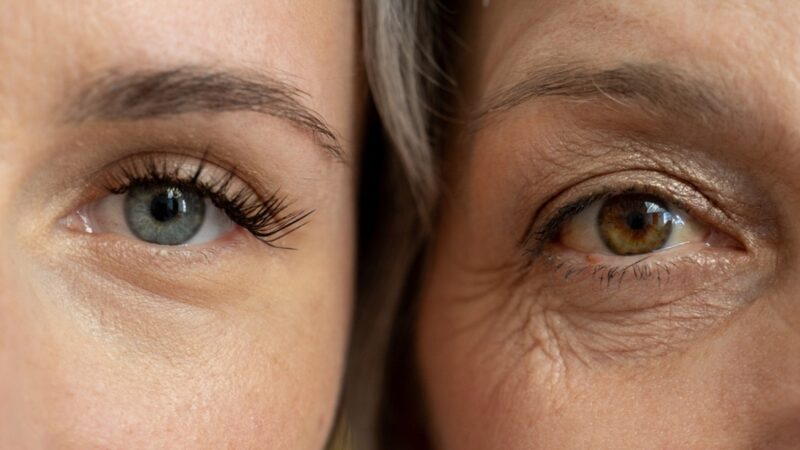 Fine Lines vs. Wrinkles: Understanding the Difference Matters